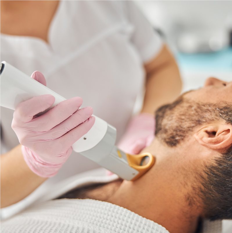 Laser hair removal treatment