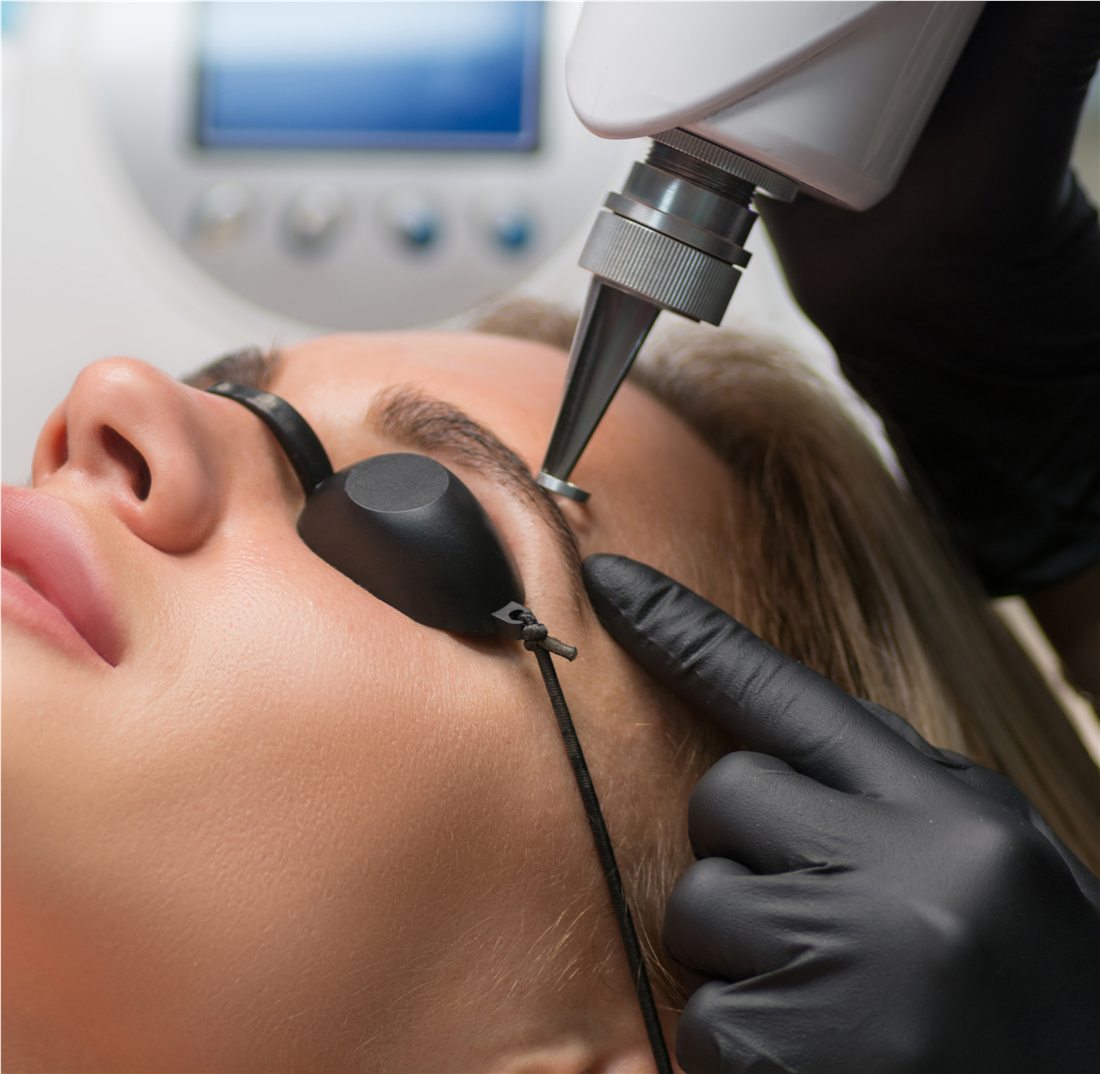 Permanent makeup removal result